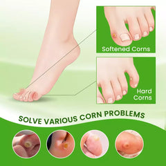Foot Corns Removal Cream